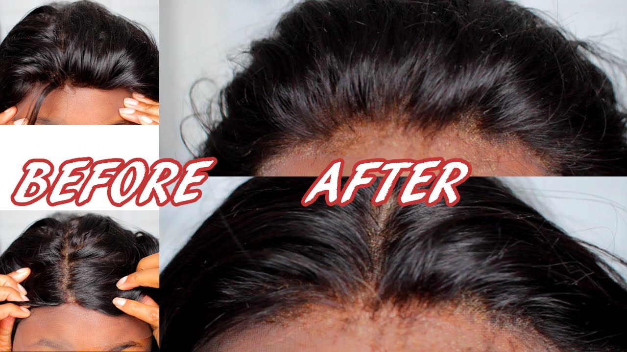 How To Fix Lace Frontal Hairline To Make Them Look Natural